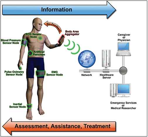 Sensors connected on a patient for Remote Health Monitoring 